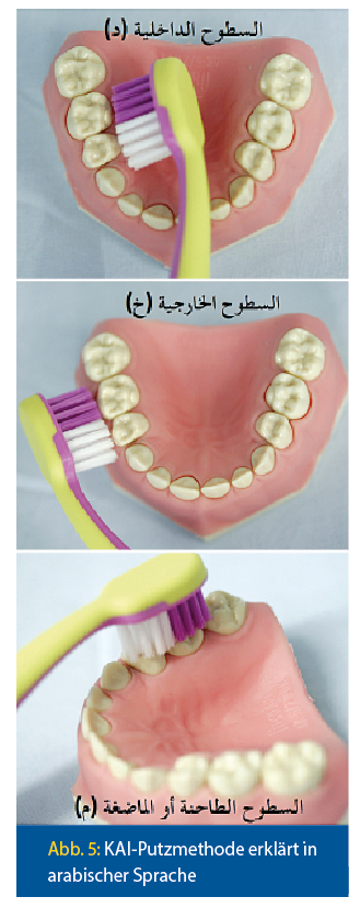 KAI-Putzmethode erklärt in  arabischer Sprache