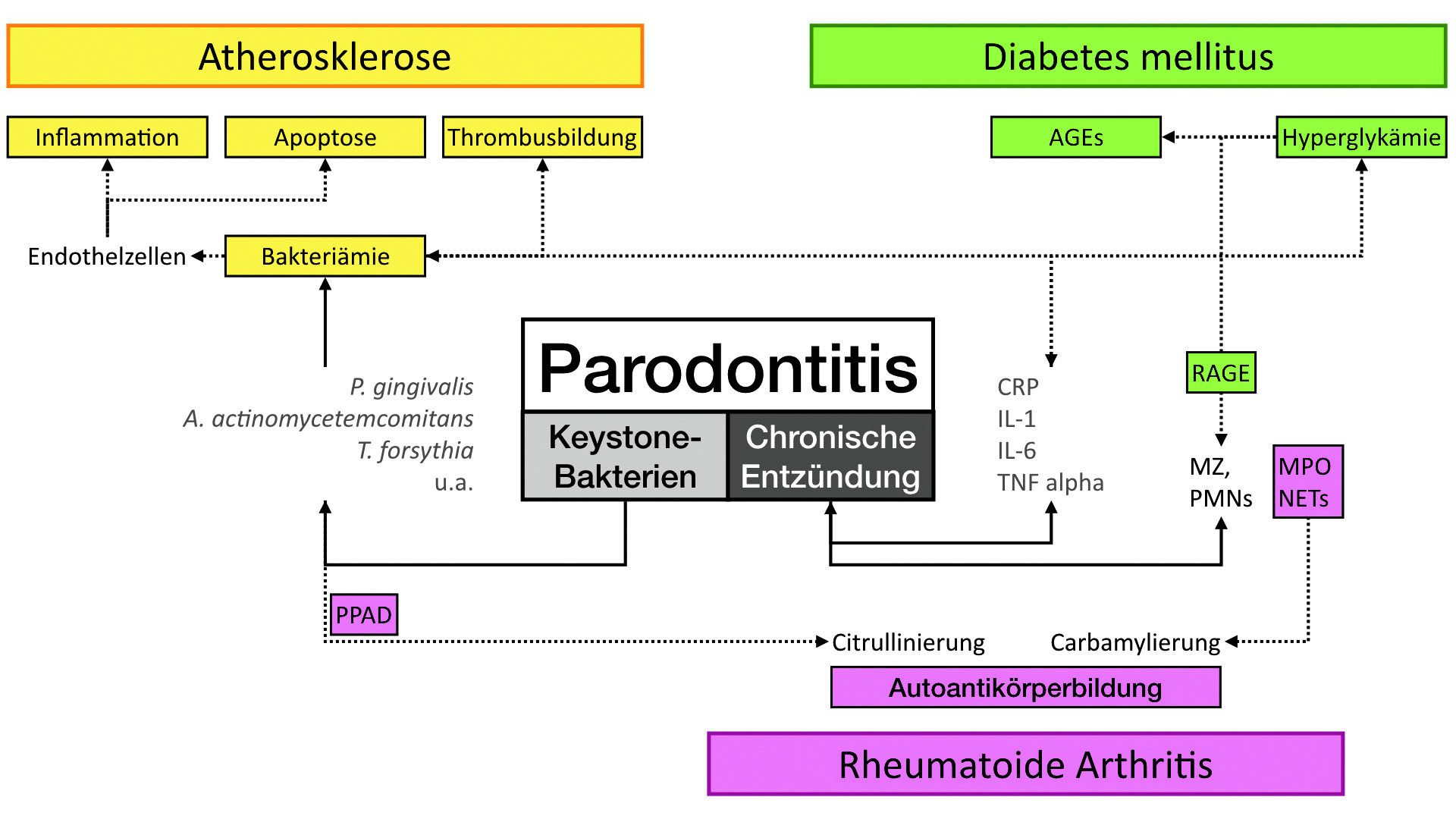 Abb. 2: Schematische Darstellung von Zusammenhängen zwischen Parodontitis und den systemischen Erkrankungen Atherosklerose, Diabetes mellitus und rheumatoide Arthritis. Erklärung der Abkürzungen: AGEs