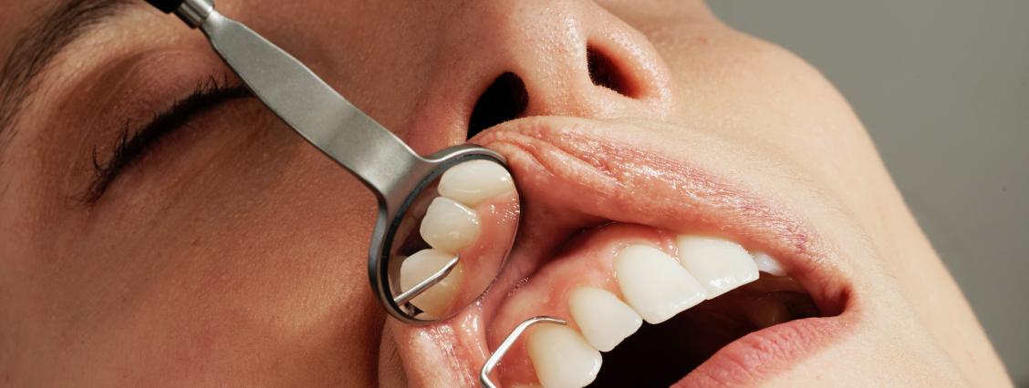 Vorsorge Zahnarzt