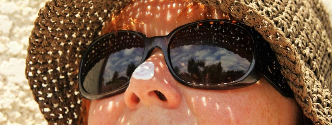 Frau mit Sonnenhut, Sonnenbrill und Creme auf der Nase