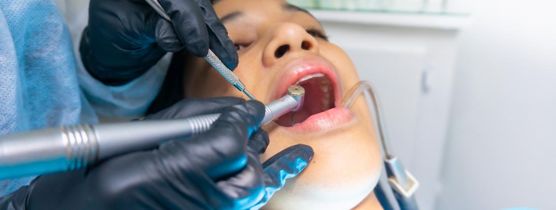 Frau bei Zahnbehandlung